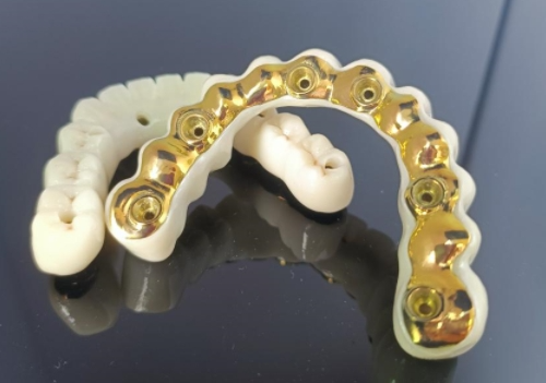 CAD/CAM Titan İmplant Çubuğu+Zirkon Körpüsü