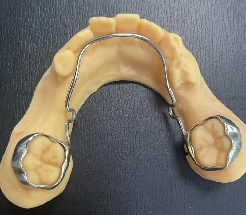 Mandibular Lingual Arch Saxlayıcısı