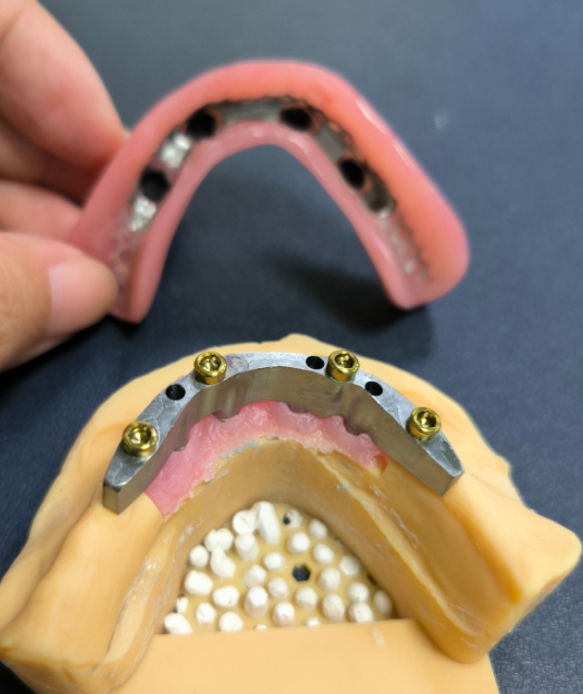 Lokator və Titan Dental Bar