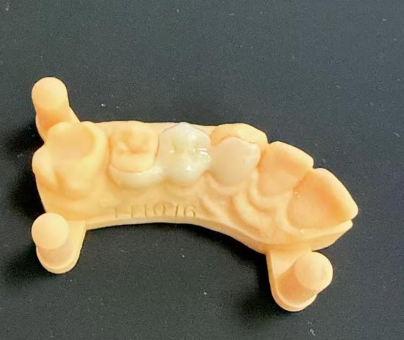 Merilend körpüləri haqqında nə bilmək lazımdır?