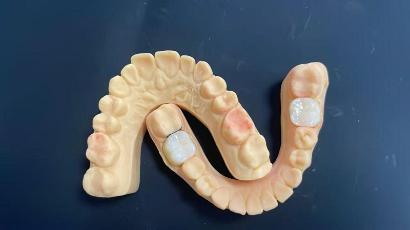 Çiyin kənarı nədir?