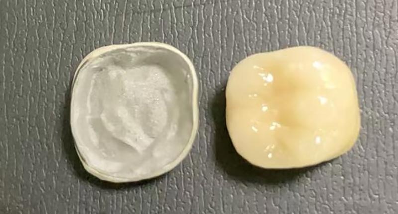 WM DENTAL LAB – Aparıcı Çin Diş Laboratoriyası