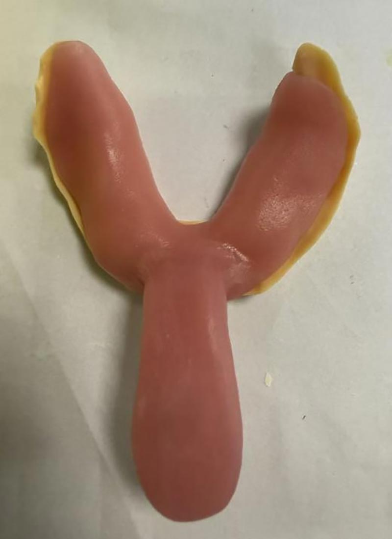 Xüsusi Diş Tablaları Haqqında Bilmədiyiniz Şeylər