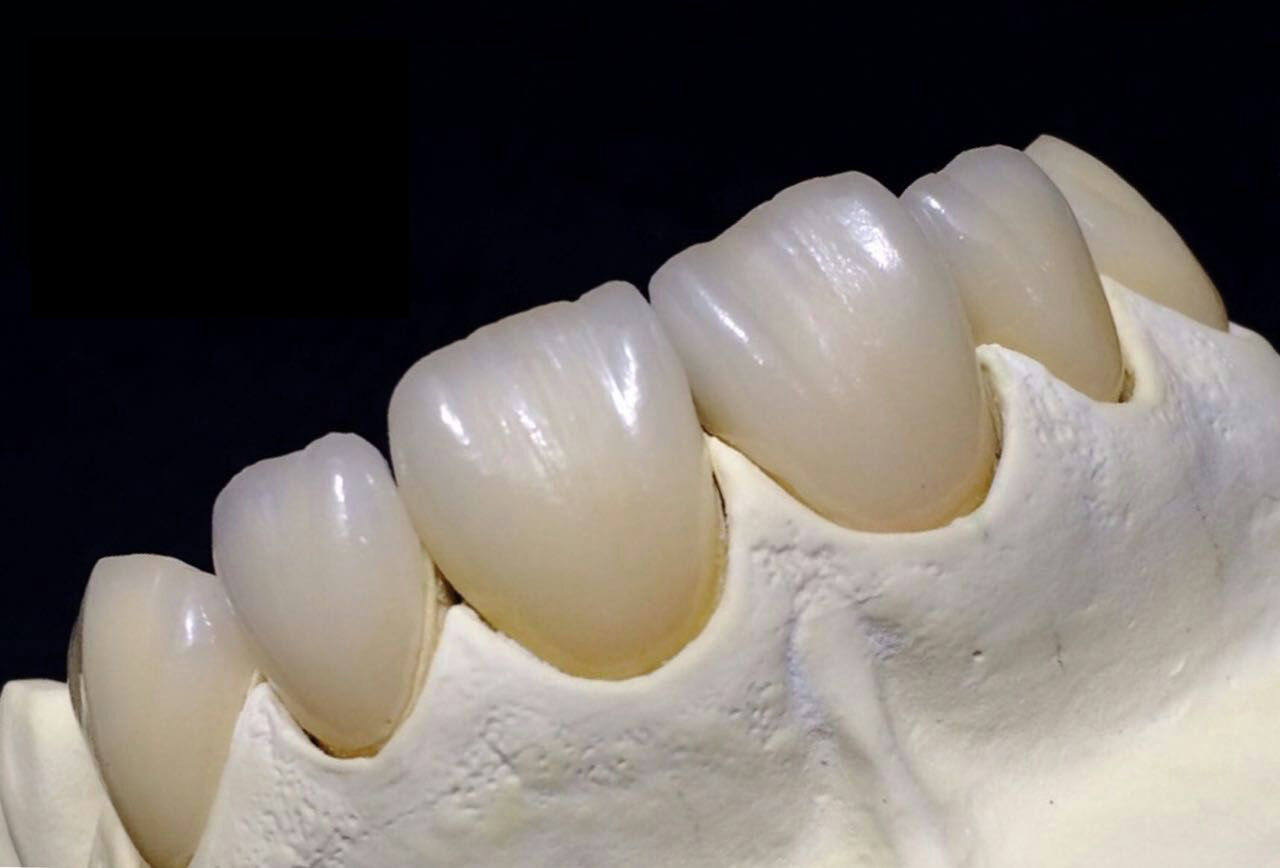 Tam Zirconia Crown Çin diş laboratoriyası