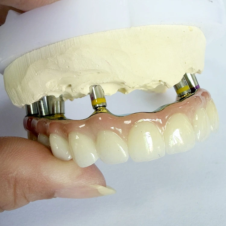 Hamısı X Zirconia Üstündə
