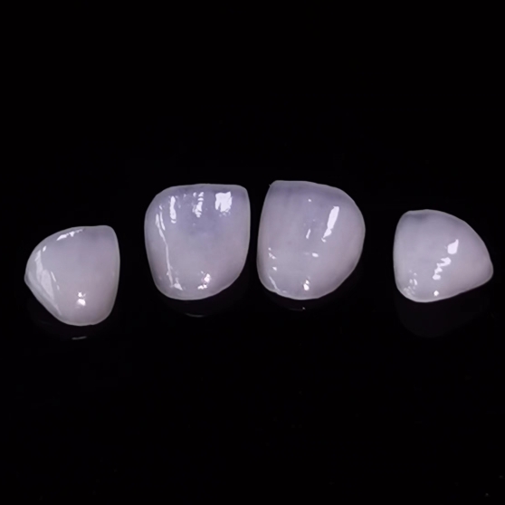 Hight Translucent Dental Veneer Layered Emax Veneer Dental laboratoriya işi