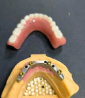 Lokator və diş barı