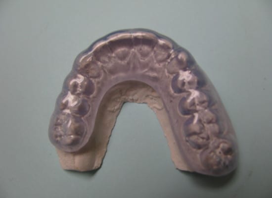 Oklüzal Brace