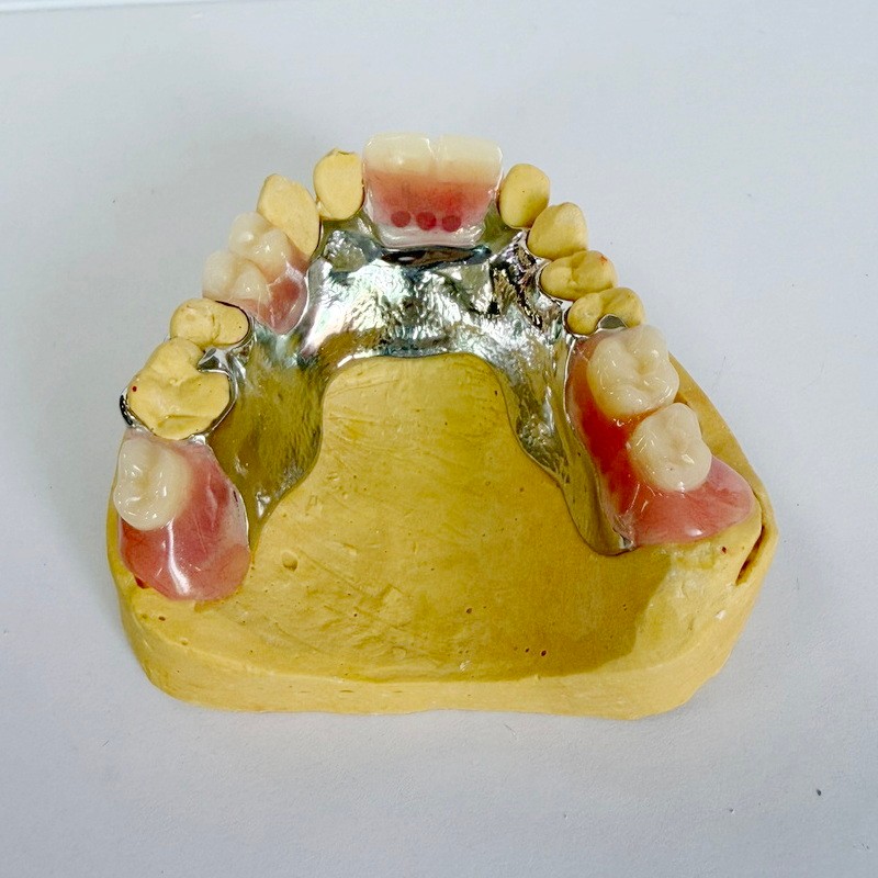 Çıxarılan Bərpa Qismən Çərçivə